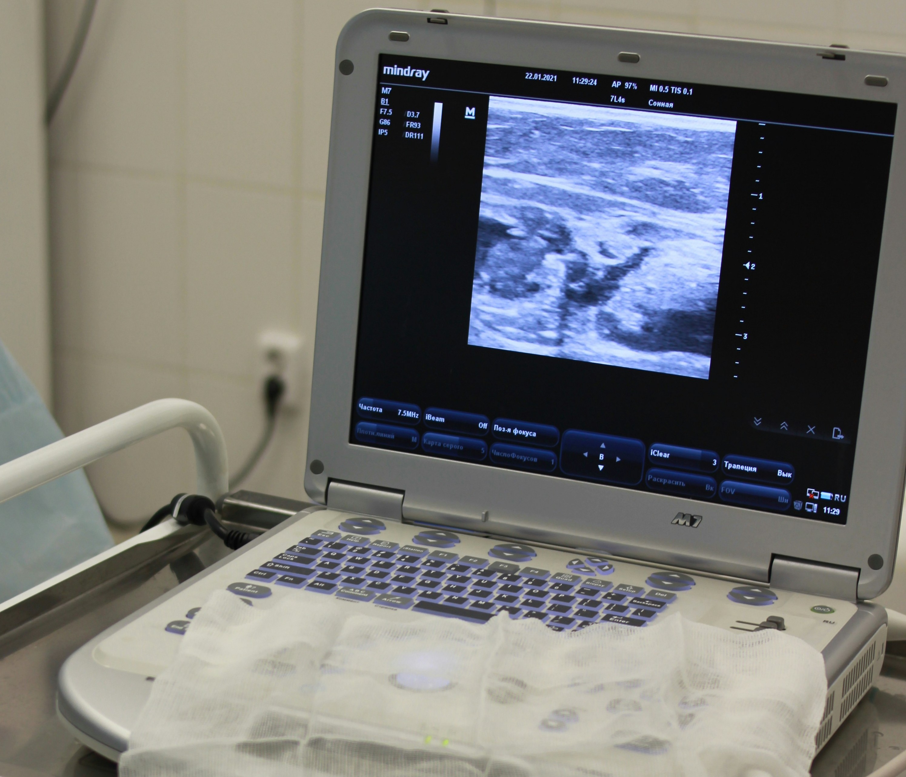 Polycystic Ovarian Syndrome diagnosis procedures using trained artificial intelligence (AI) and machine learning (ML) models are now possible thanks to recent technological advances. Image by Elen Sher via Unsplash